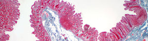 The Gut-Blood Barrier: A Crucial Guardian of Health and Wellness