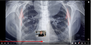 What Vaping Does to the Body
