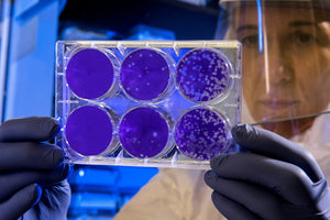 Unlocking the Power of Stem Cells: Recovery from Chronic Disease Through Diet and Supplements